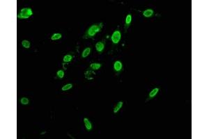 Immunofluorescence staining of Hela cells with ABIN7155093 at 1:166, counter-stained with DAPI. (HNRNPAB antibody  (AA 1-68))