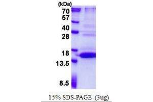 Figure annotation denotes ug of protein loaded and % gel used. (UFSP1 Protein)