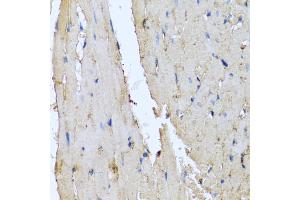 Immunohistochemistry of paraffin-embedded rat heart using DEFA1 antibody (ABIN5974152) at dilution of 1/100 (40x lens). (alpha Defensin 1 antibody)