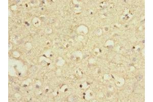 Immunohistochemistry of paraffin-embedded human brain tissue using ABIN7159448 at dilution of 1:100 (GRM7 antibody  (AA 220-410))