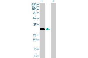 Western Blot analysis of UNC84A expression in transfected 293T cell line by UNC84A MaxPab polyclonal antibody. (SUN1 antibody  (AA 1-257))