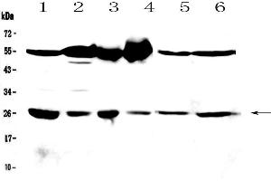 Western blot analysis of GSTM3 using anti-GSTM3 antibody .
