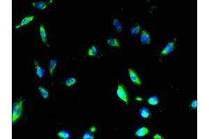 Immunofluorescent analysis of U251 cells using ABIN7160187 at dilution of 1:100 and Alexa Fluor 488-congugated AffiniPure Goat Anti-Rabbit IgG(H+L) (MMD2 antibody  (AA 1-38))