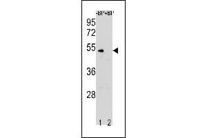 Western blot analysis of CCNB1 Antibody (N-term S9) Pab (ABIN1881151 and ABIN2843318) pre-incubated without(lane 1) and with(lane 2) blocking peptide in K562 cell line lysate. (Cyclin B1 antibody  (N-Term))