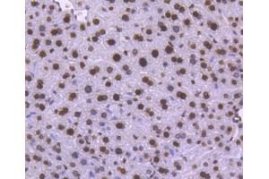 Paraformaldehyde-fixed, paraffin embedded human pancreas tissue, Antigen retrieval by boiling in sodium citrate buffer (pH6) for 15min, Block endogenous peroxidase by 3% hydrogen peroxide for 30 minutes, Blocking buffer (normal serum) at 37°C for 20min, Antibody incubation with Histone H1. (Histone H1 antibody)