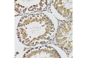 Immunohistochemistry of paraffin-embedded mouse testis using HSPA9 antibody.