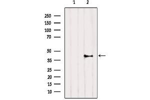 Western blot analysis of extracts from HepG2, using CNR2 Antibody. (CNR2 antibody  (C-Term))
