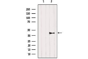 Western blot analysis of extracts from HepG2, using CNR2 Antibody.