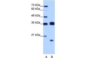 WB Suggested Anti-HNRPH3 Antibody Titration:  1. (HNRNPH3 antibody  (N-Term))