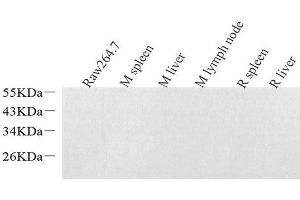 Western Blot analysis of various samples using Lysozyme Polyclonal Antibodyat dilution of 1:1000. (LYZ antibody)