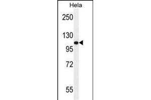 ANDR Antibody (Sumo-site) (ABIN389077 and ABIN2850530) western blot analysis in Hela cell line lysates (35 μg/lane). (Androgen Receptor antibody  (AA 365-392))