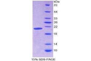 SDS-PAGE (SDS) image for Ionized Calcium-binding Adapter Molecule 1 (IBA1) protein (His tag) (ABIN2127545)
