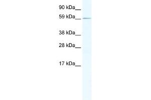 WB Suggested Anti-RBM14 Antibody Titration:  1. (RBM14 antibody  (N-Term))