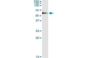 Immunoprecipitation of DEPDC7 transfected lysate using anti-DEPDC7 MaxPab rabbit polyclonal antibody and Protein A Magnetic Bead , and immunoblotted with DEPDC7 purified MaxPab mouse polyclonal antibody (B01P) . (DEPDC7 antibody  (AA 1-511))