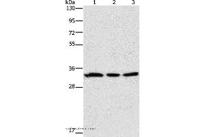 Western blot analysis of 293T and human colon cancer tissue, 231 cell, using GPA33 Polyclonal Antibody at dilution of 1:600 (GPA33 antibody)