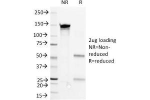 SDS-PAGE Analysis Purified CD36 Mouse Monoclonal Antibody (1E8). (CD36 antibody)