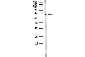 anti-Spermatogenesis and Oogenesis Specific Basic Helix-Loop-Helix 2 (SOHLH2) antibody