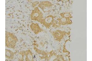 ABIN6269268 at 1/100 staining Human lung tissue by IHC-P.