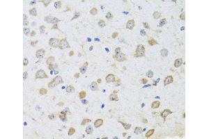 Immunohistochemistry of paraffin-embedded Mouse brain using ARL6 Polyclonal Antibody at dilution of 1:100 (40x lens). (ARL6 antibody)
