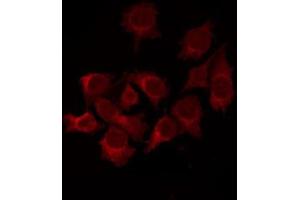 ABIN6267624 staining 293 by IF/ICC. (BCL2L1 antibody  (pSer62))