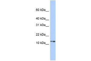 WB Suggested Anti-GNGT2 Antibody Titration: 0. (GNGT2 antibody  (Middle Region))