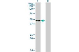 Western Blot analysis of PAX2 expression in transfected 293T cell line by PAX2 monoclonal antibody (M01), clone 3C7. (PAX2A antibody  (AA 194-303))