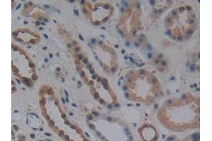 DAB staining on IHC-P; Samples: Human Kidney Tissue (WNT10B antibody  (AA 30-322))