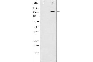 Western Blotting (WB) image for anti-Mitogen-Activated Protein Kinase Kinase Kinase 5 (MAP3K5) (pSer966) antibody (ABIN6255571)