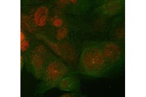IF analysis of ST7 using anti-ST7 antibody (ABIN4886732) and anti-Beta Tubulin antibody (ABIN7602743). (ST7 antibody  (Middle Region))
