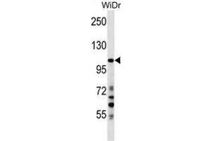 SUSD2 Antibody (C-term) western blot analysis in WiDr cell line lysates (35 µg/lane). (SUSD2 antibody  (C-Term))