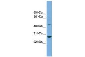 Image no. 1 for anti-Zinc Finger Protein 514 (ZNF514) (C-Term) antibody (ABIN6744688) (ZNF514 antibody  (C-Term))