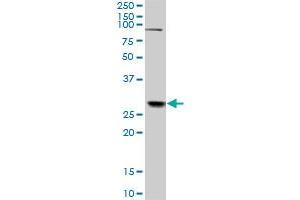 TGIF2 monoclonal antibody (M01), clone 4C10. (TGIF2 antibody  (AA 131-236))