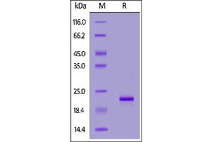 Biotinylated Human Allein, His,Avitag on  under reducing (R) condition. (SNCA Protein (AA 1-140) (His tag,AVI tag,Biotin))