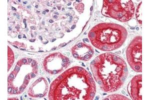 Human Kidney (formalin-fixed, paraffin-embedded) stained with ACE2at 2. (ACE2 antibody  (N-Term))
