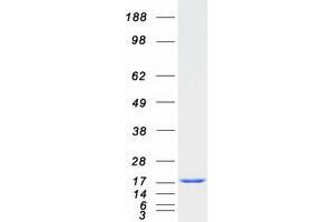 Validation with Western Blot (RBP1 Protein (Transcript Variant 1) (Myc-DYKDDDDK Tag))