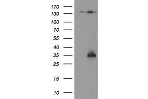NQO2 antibody