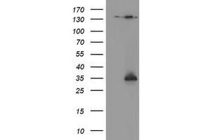 Western Blotting (WB) image for anti-NQO2 (NQO2) antibody (ABIN1499816)