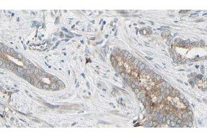 ABIN6276518 at 1/100 staining Human prostate tissue by IHC-P. (Glutathione Peroxidase 1 antibody  (Internal Region))