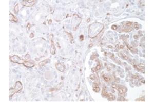 Image no. 1 for anti-Complement Component 3 (C3) antibody (ABIN951636) (C3 antibody)