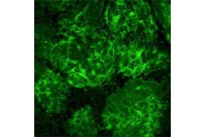 Immunofluorescence (IF) image for anti-Nerve Growth Factor Receptor (NGFR) antibody (ABIN350707)