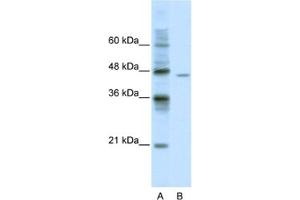 Western Blotting (WB) image for anti-DEAD (Asp-Glu-Ala-Asp) Box Polypeptide 25 (DDX25) antibody (ABIN2461348) (DDX25 antibody)
