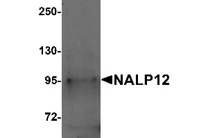 Western Blotting (WB) image for anti-NLR Family, Pyrin Domain Containing 12 (NLRP12) (N-Term) antibody (ABIN1031467) (NLRP12 antibody  (N-Term))
