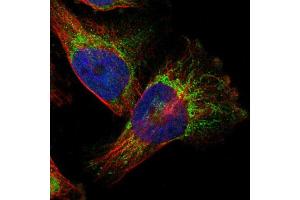 Immunofluorescent staining of U251 cells using TAOK3 polyclonal antibody  shows positivity in mitochondria (green). (TAO Kinase 3 antibody  (AA 323-432))