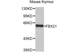 Western Blotting (WB) image for anti-T-Bet (AA 326-535) antibody (ABIN6220736) (T-Bet antibody  (AA 326-535))