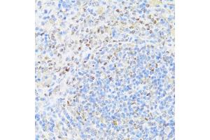 Immunohistochemistry (IHC) image for anti-Mitochondrial Nucleoid Factor 1 (MNF1) (AA 14-126) antibody (ABIN6149954)