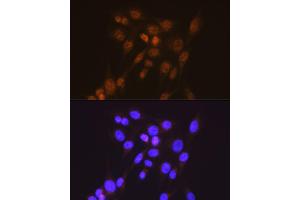 Immunofluorescence analysis of NIH-3T3 cells using [KO Validated] Smad2 Rabbit mAb (ABIN7270344) at dilution of 1:100 (40x lens). (SMAD2 antibody)