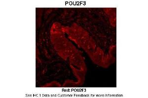 Sample Type :  Mouse tongue tissue  Primary Antibody Dilution :  1:100  Secondary Antibody :  Anti-rabbit-Cy3  Secondary Antibody Dilution :  1:500  Color/Signal Descriptions :  Red: POU2F3  Gene Name :  POU2F3  Submitted by :  Dr.