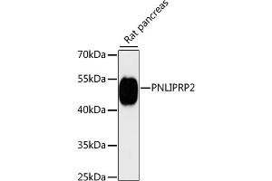 PNLIPRP2 antibody  (AA 301-470)