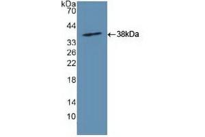 Detection of Recombinant GLS, Human using Polyclonal Antibody to Glutaminase (GLS) (Glutaminase antibody  (AA 221-533))