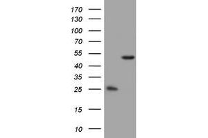 Image no. 4 for anti-3-Oxoacyl-ACP Synthase, Mitochondrial (OXSM) (AA 78-343) antibody (ABIN1491676) (OXSM antibody  (AA 78-343))